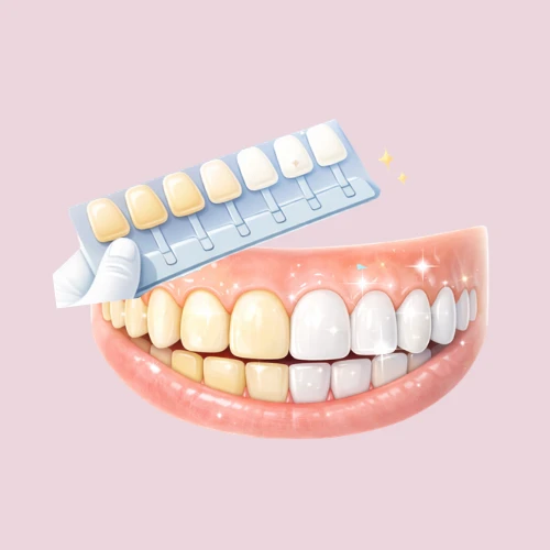 ฟอกฟันขาว & วีเนียร์